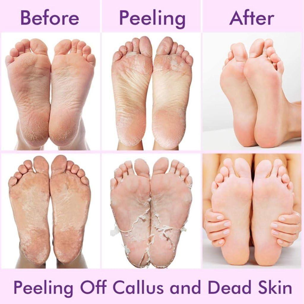 Exfoliating Foot Mask | Reduces Dry Skin & Hard Calluses