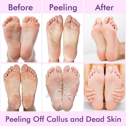 Exfoliating Foot Mask | Reduces Dry Skin & Hard Calluses
